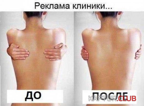 0ca7daf0c57c20aa34727d6f23f_prev.jpg | Рено Каптур Клуб Россия | Форум KAPTUR.SU