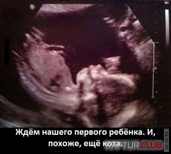 1.png | Рено Каптур Клуб Россия | Форум KAPTUR.SU