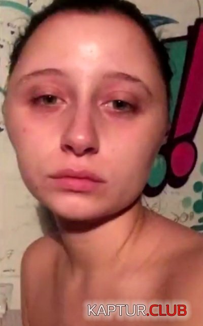 allergy_hair_dye_03.jpg | Рено Каптур Клуб Россия | Форум KAPTUR.SU