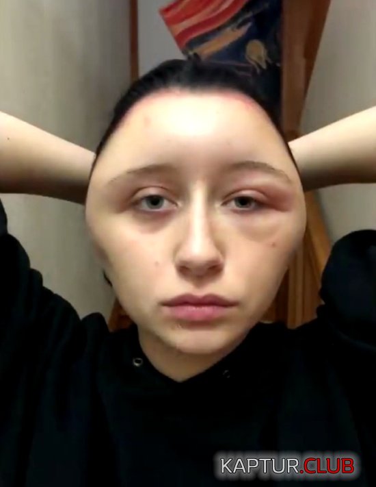 allergy_hair_dye_05.jpg | Рено Каптур Клуб Россия | Форум KAPTUR.SU