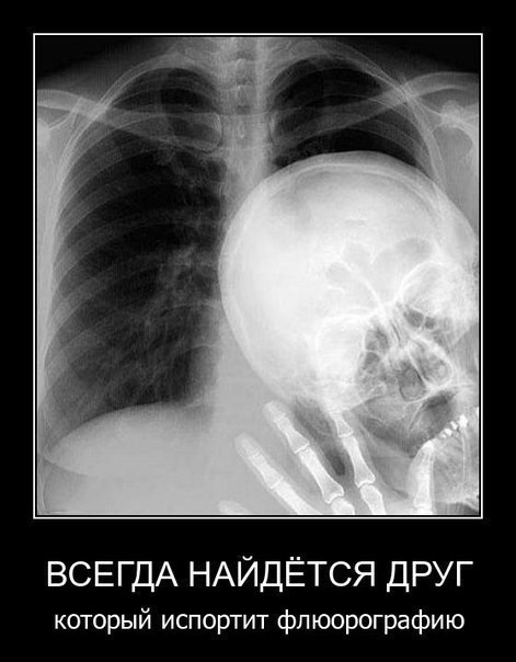 proxy.php?image=http%3A%2F%2Fs00.yaplakal.com%2Fpics%2Fpics_original%2F2%2F0%2F8%2F9819802.jpg&hash=4d628f9893012a8d66cad7724bde298f | Рено Каптур клуб Россия | www.KAPTUR.club