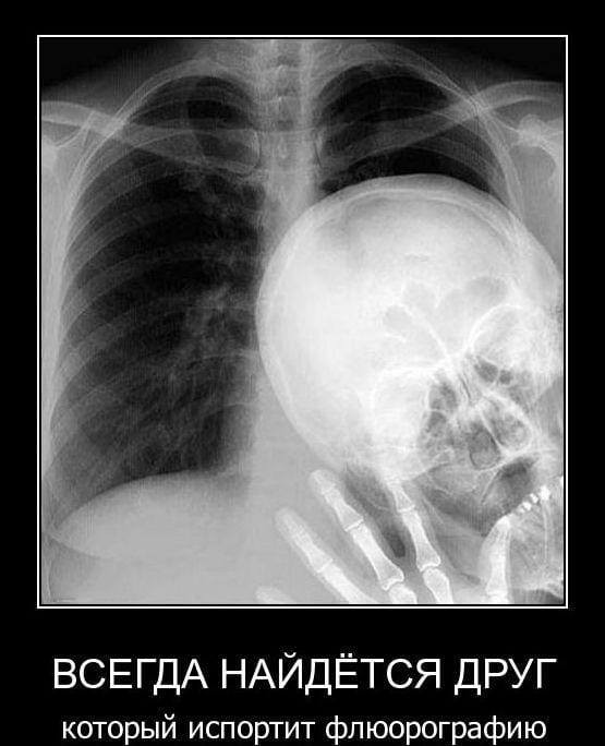 proxy.php?image=http%3A%2F%2Fs00.yaplakal.com%2Fpics%2Fpics_preview%2F3%2F2%2F3%2F12219323.jpg&hash=f3b5fb097790d0f2a9bd9cc5767ed834 | Рено Каптур клуб Россия | www.KAPTUR.club